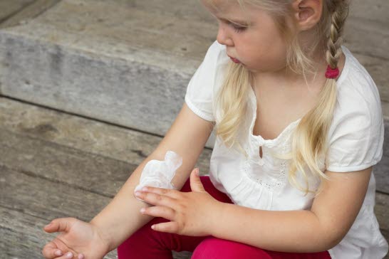 Flicka med böjveckseksem som smörjer sin arm.